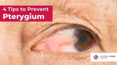Prevent pterygium article header – First Aid Article in Hunter Valley